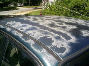 افتاب سوختگی